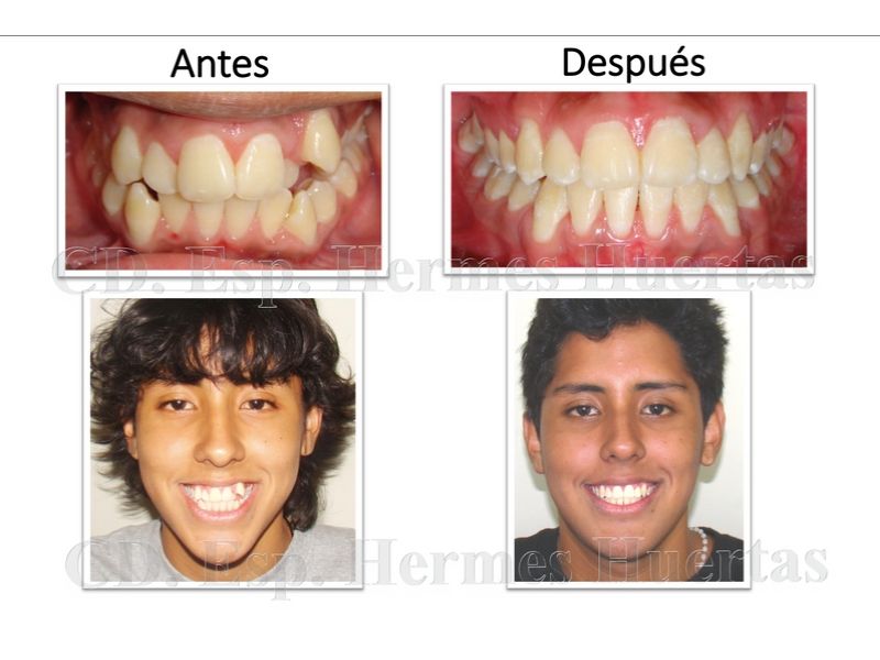 Ortodoncista en Surquillo